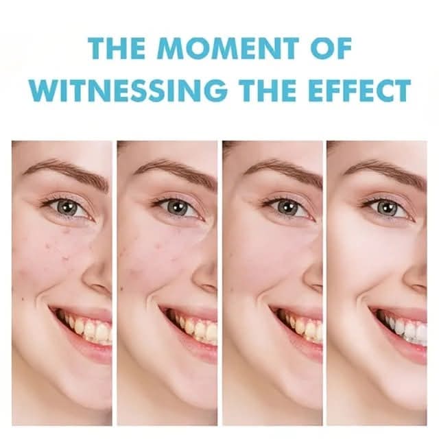 Clarifying Acne Treatment