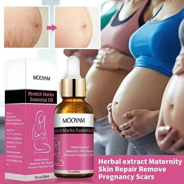 Stretch Marks Essential Oil with packaging and images of pregnant women showing stretch marks.