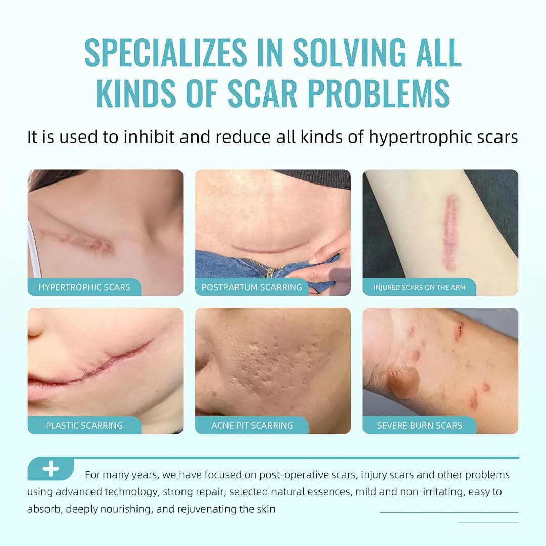 Advertisement for a product specializing in solving scar problems with images of different types of scars.