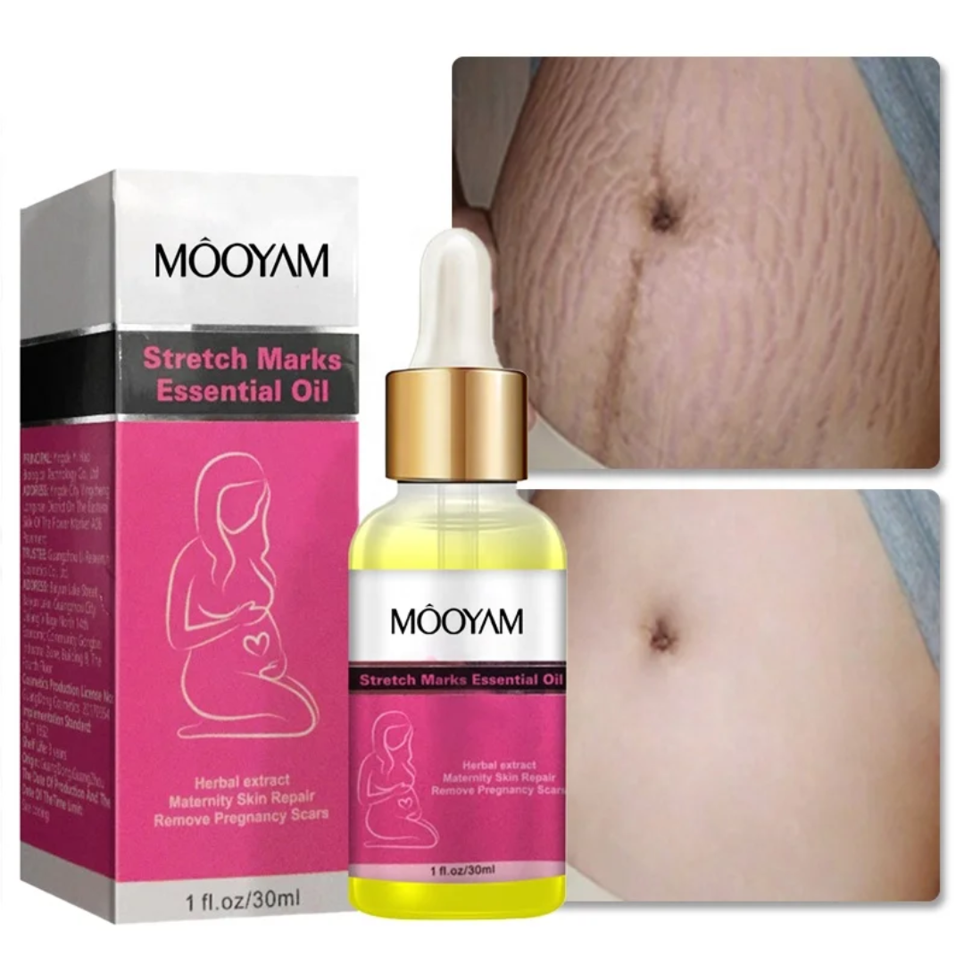 Stretch Mark Repair Treatment