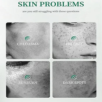 Dark Spot Correcting Cream