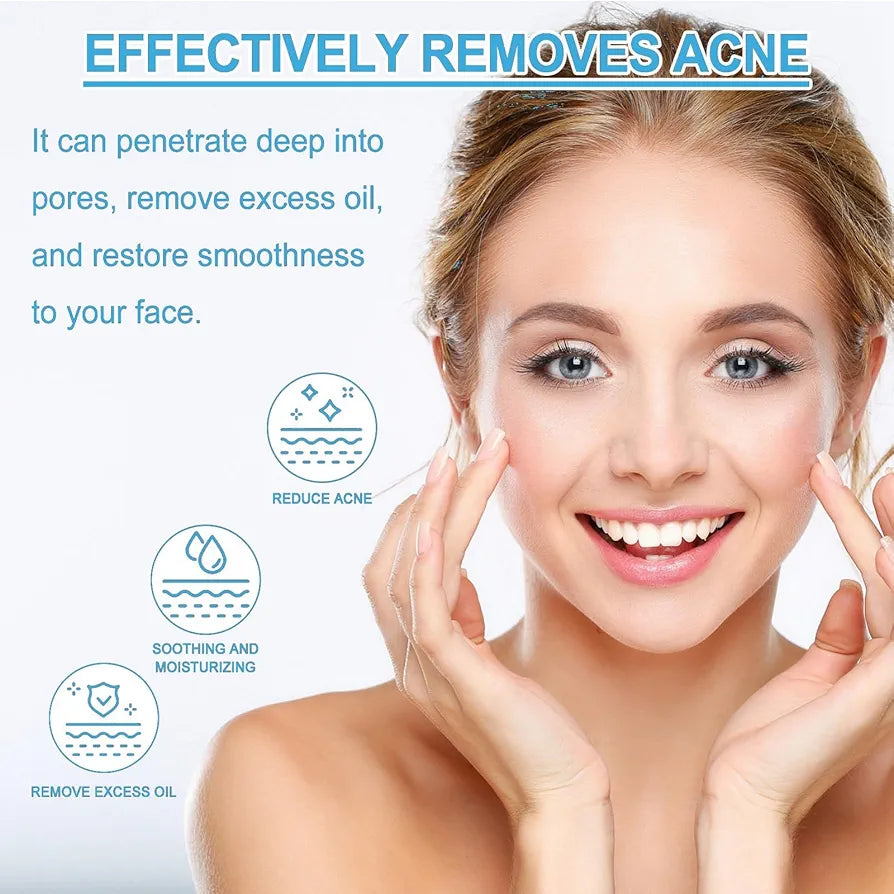 Clarifying Acne Treatment