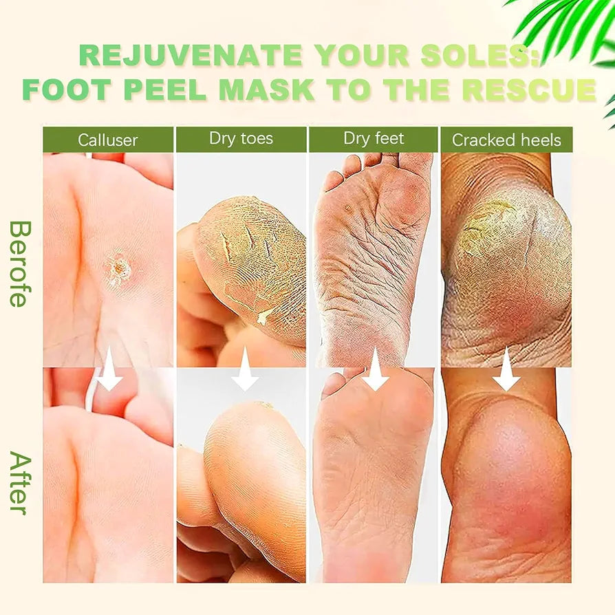 Foot Renewal Mask