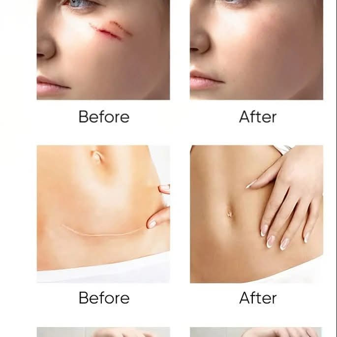 Advanced Scar Repair Complex